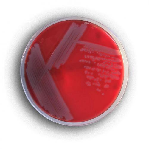Опасно ли обнаружение кишечной палочки (escherichia coli) в моче?