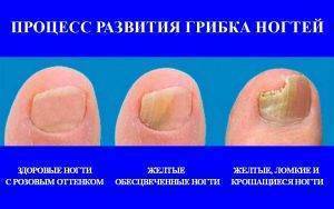 Ремисид инструкция по применению
