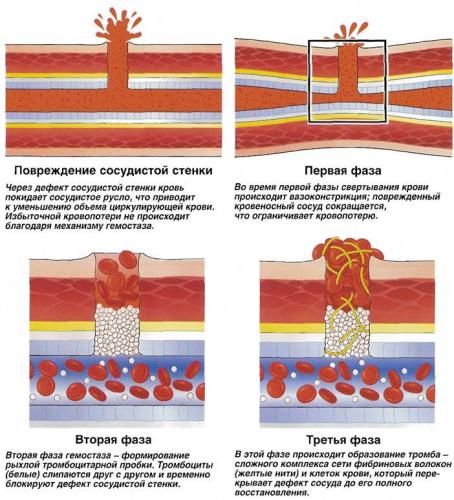О чем говорит повышение или понижение тромбоцитов в крови
