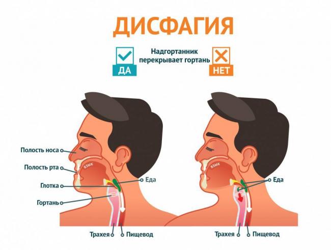 Болит горло с правой стороны при глотании с температурой и без