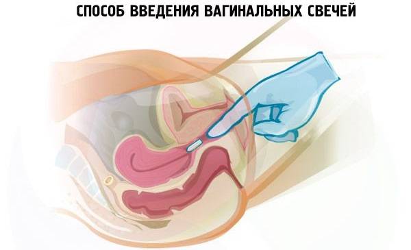 Эротекс отзывы