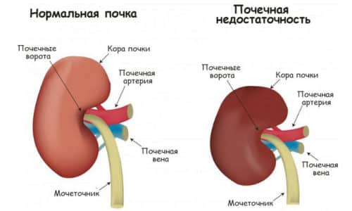 Зептол инструкция по применению цена отзывы аналоги