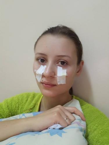 Прокол носа при гайморите: плюсы и минусы процедуры