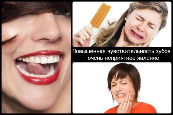 Отбеливание зубов: вред и польза самых действенных методов