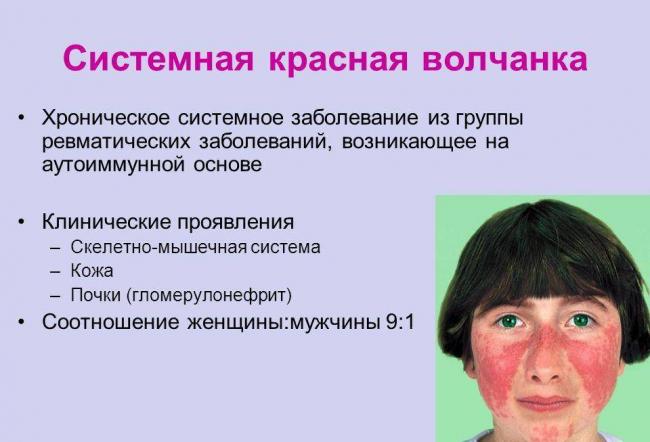 Противокоронавирусные средства - лекарство от коронавируса 2020
