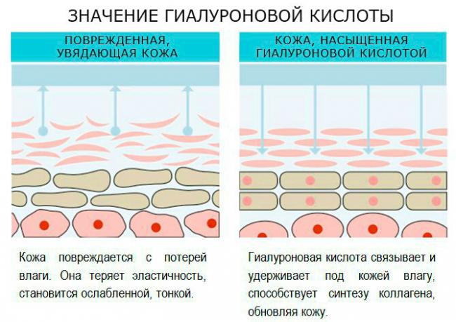 Гиалуроновая кислота в капсулах: отзывы покупателей и врачей, инструкция по применению