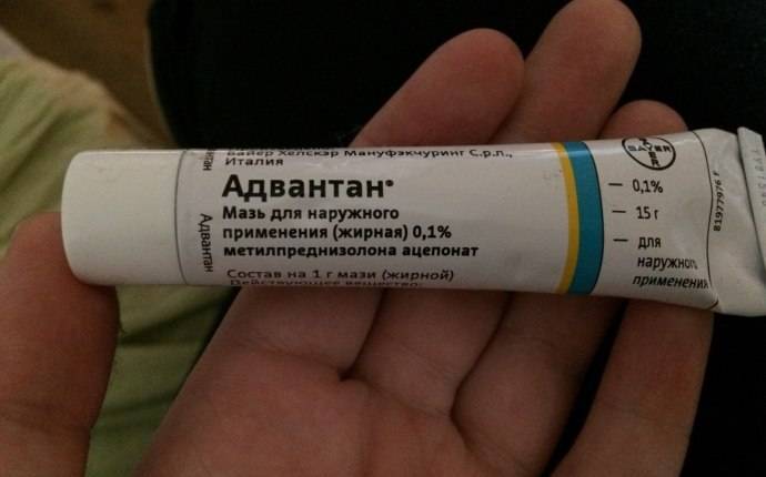 Как избавиться от дерматита на ногах