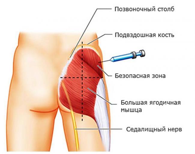 Сустагард Артро