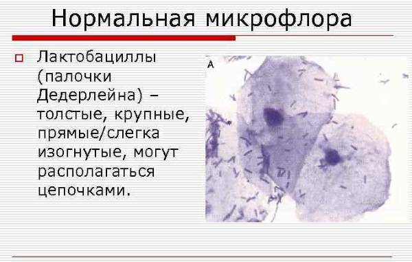Значение выявления бактерий в мазках различной локализации