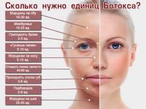 Ботокс и диспорт: что лучше, аналоги / mama66.ru