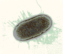 Escherichia coli и как бороться с ней