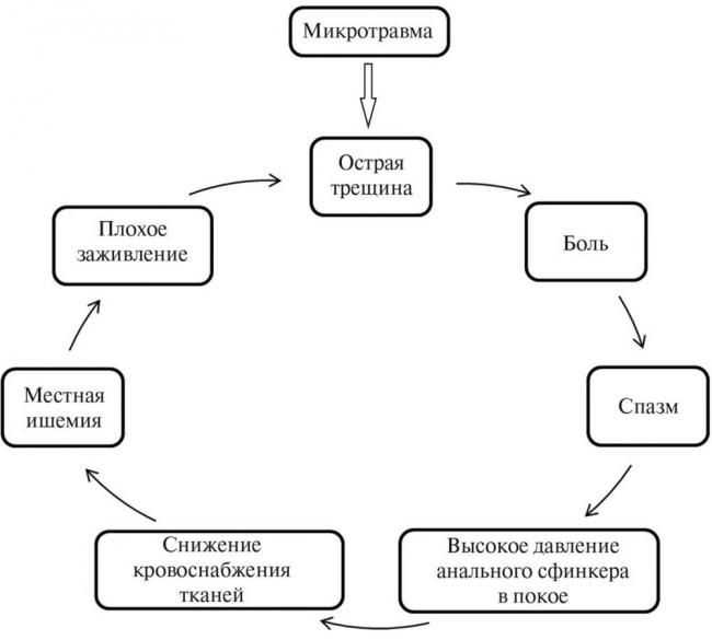 Анальная трещина: причины, лечение, прогноз — онлайн-диагностика