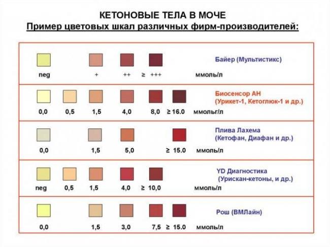 Ацетон в моче у ребенка, кетоновые тела, кетоны: запах изо рта, причины, признаки повышенной нормы и лечение