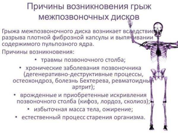 Грыжа диска с5 с6 шейного отдела позвоночника при остеохондрозе
