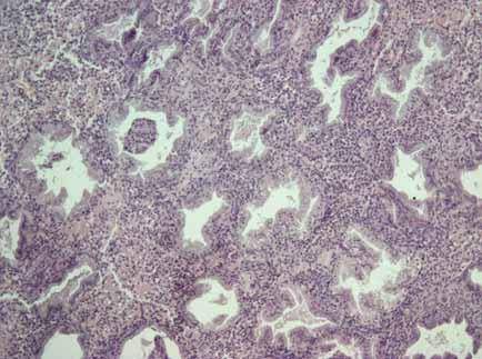 Слизистая оболочка матки - endometrium - qwe.wiki