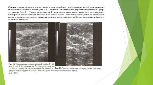 Как увеличить железистую ткань молочной железы
