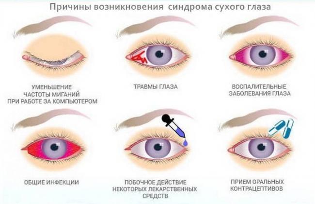Покраснение глаз