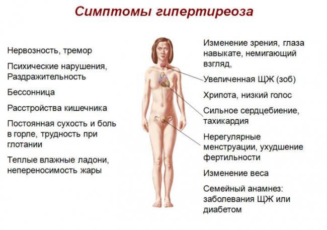 Зоб щитовидной железы. причины, симптомы, диагностика и лечение зоба