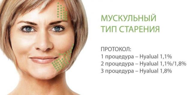 Гиподерма