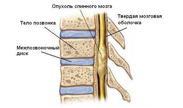 На спине около позвоночника уплотнение
