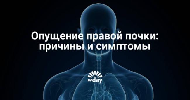 Нефроптоз