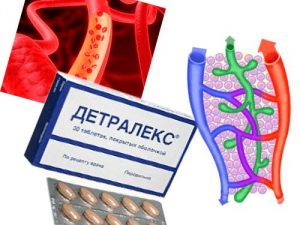 Таблетки детралекс при геморрое