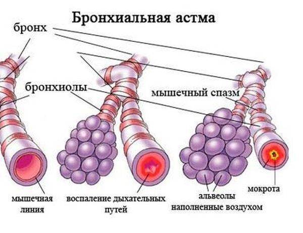Бронхорус таблетки инструкция по применению