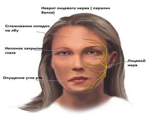 Тройничный нерв