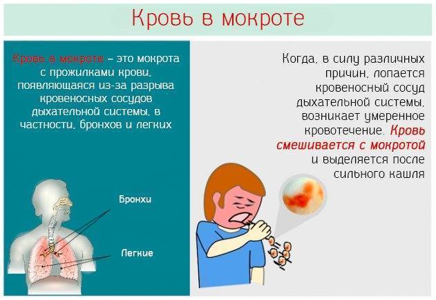 Причины крови в мокроте при отхаркивании - диагностика и лечение у детей и взрослых