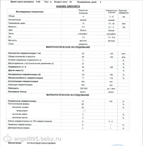 Расскажем про варикоцеле и бесплодие и влияет ли болезнь на зачатие ребенка?