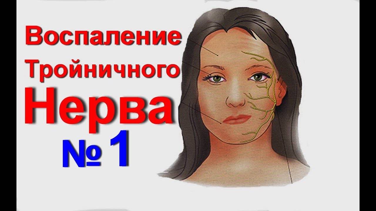 Лечение неврита тройничного нерва