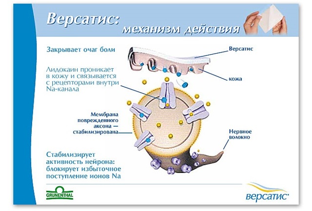 Местноанестезирующее средство пролонгированного действия с лидокаином пластырь версатис: инструкция по применению, цена, отзывы, аналоги оригинального лечебного средства