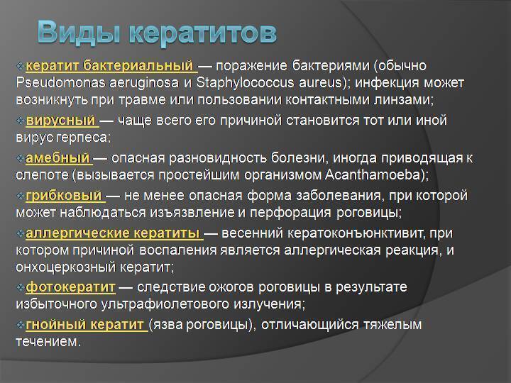 Воспаление глаза роговицы: причины, симптомы, лечение