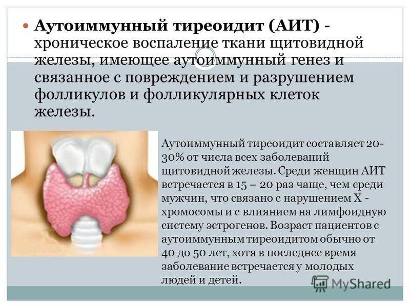 Симптомы и лечение острого тиреоидита