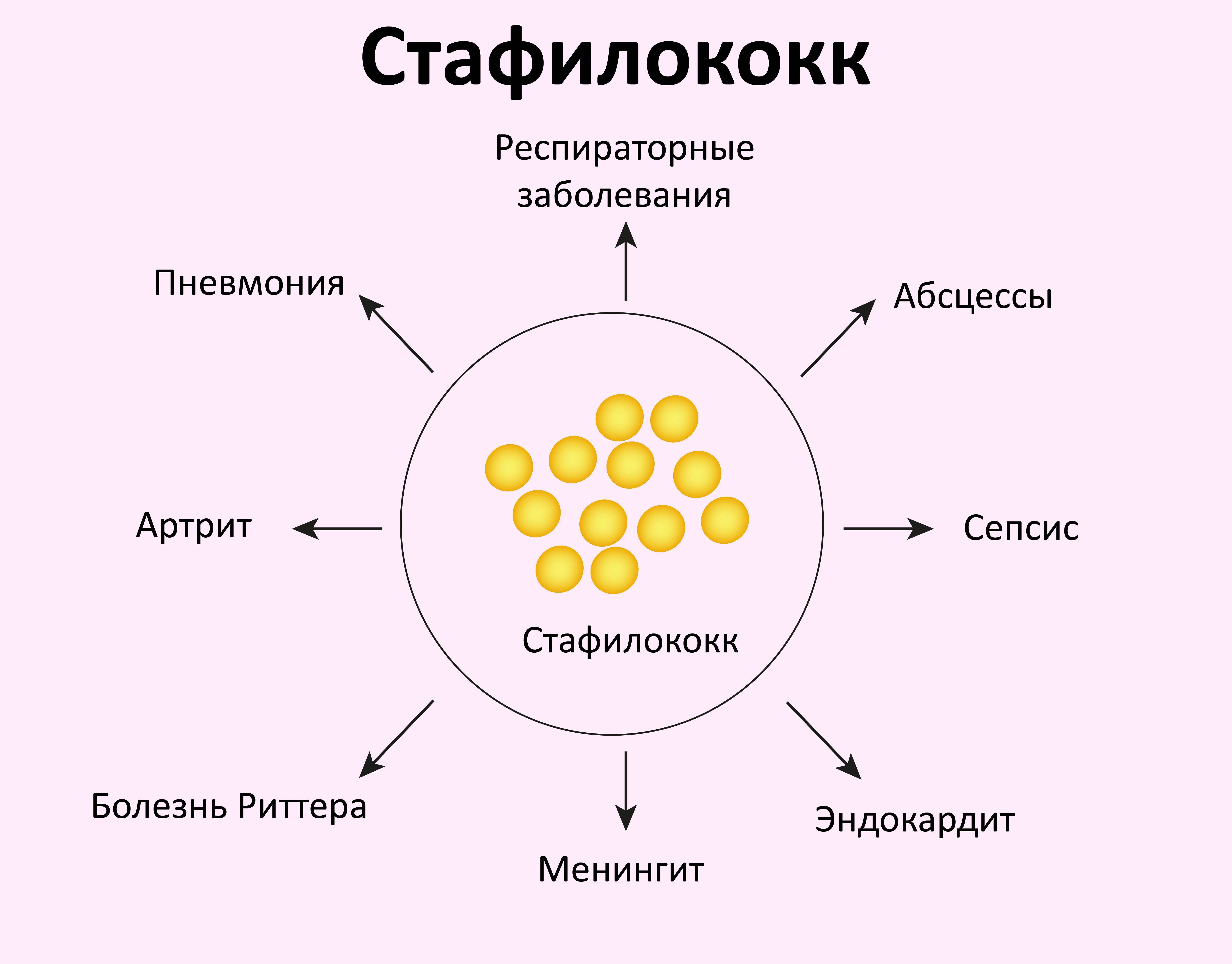 Стафилококковая пневмония: причины заболевания, основные симптомы, лечение и профилактика