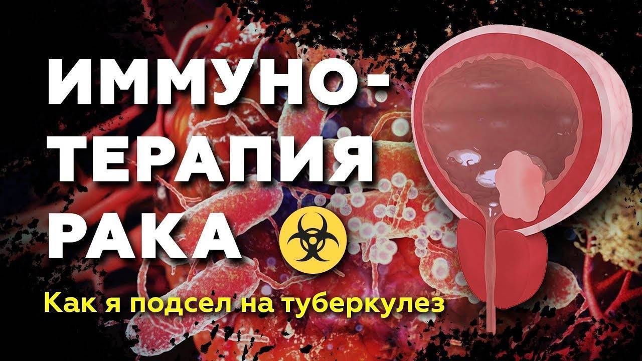 Внутрипузырная иммунотерапия и фотодинамическая терапия при раке мочевого пузыря