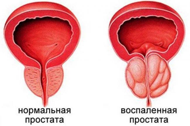 Болезнетворные бактерии: на коже, во рту, в кишечнике. фото грибков и бактерий