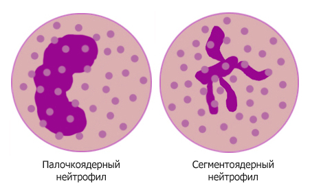 Диета при миеломе