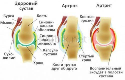 Индометацин Софарма