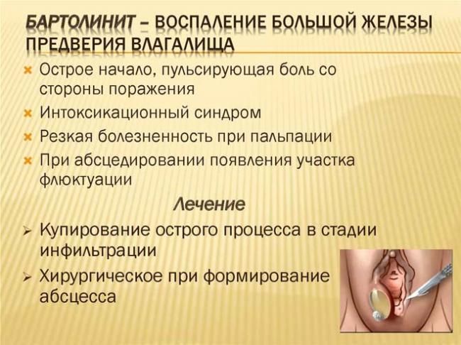 Абсцесс бартолиновой железы - симптомы и лечение