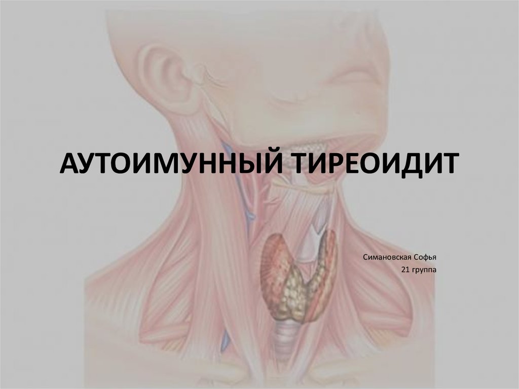 Тиреоидит щитовидной железы