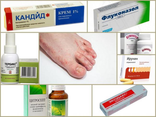 Орунгал от грибка ногтей