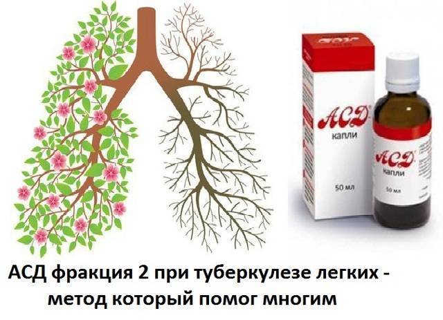 Как принимать асд 2 для повышения иммунитета при туберкулезе?