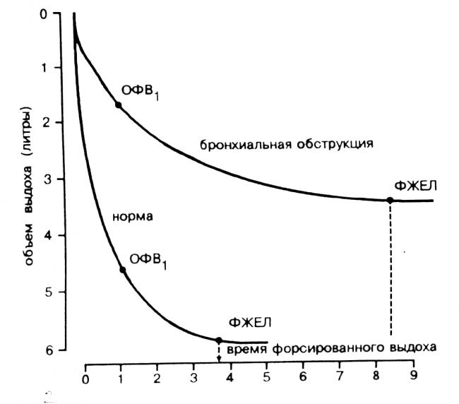Спирография