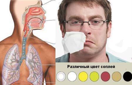 Чем лечить густые сопли белого цвета у взрослого