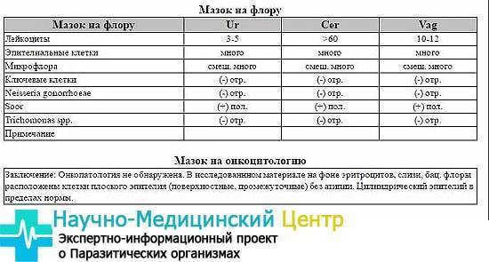 Мазок на флору у женщин: таблица норм с расшифровкой результатов