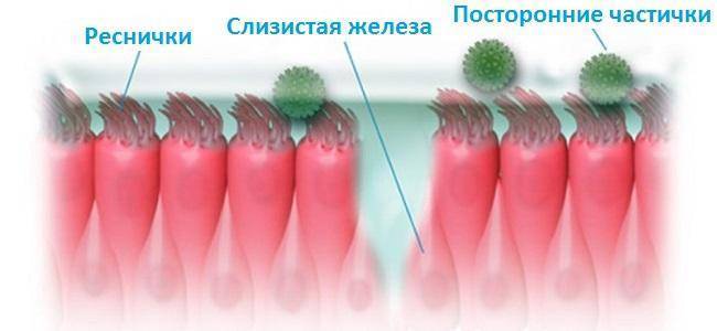 Ринит атрофический