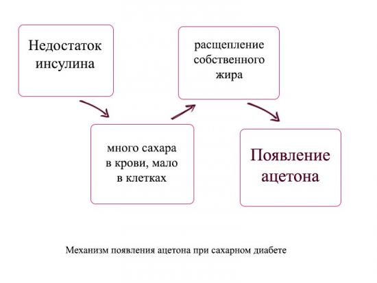 Кетоны в моче у беременной