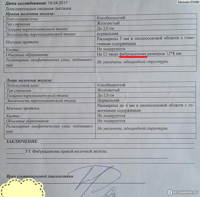 Уплотнения в молочной железе у женщин: виды, причины, что это значит