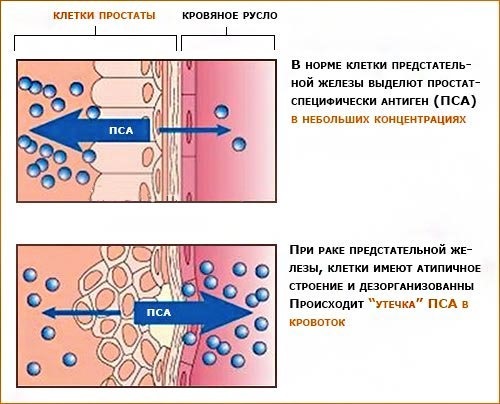 Афалаза — эффективное средство для лечения аденомы простаты